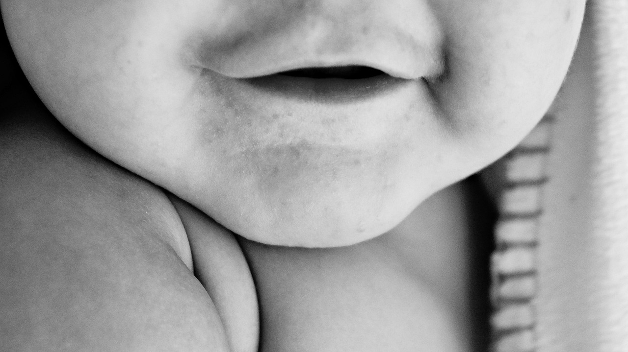 酒渣鼻新进展,治疗与研究的新突破与成果展示